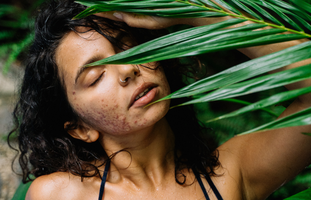 7 Simple Natural Remedies For Glowing Skin